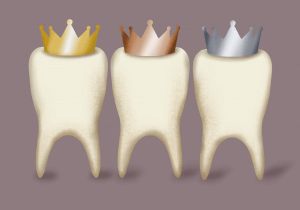 Dental Materials Questions